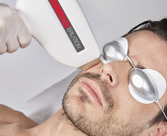 épilation défintive laser diode hd matrix 808 nm -1064 (nd yag) - 980 nm- homme barbe