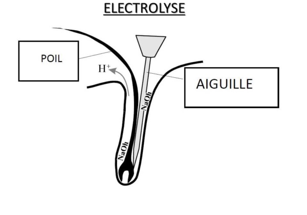 Electrolyse